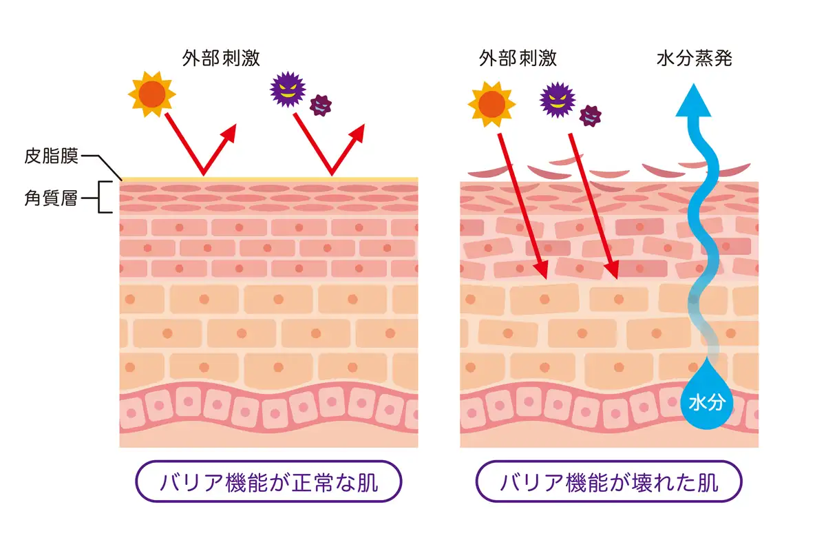 肌,バリア機能,低下,敏感肌,乾燥肌